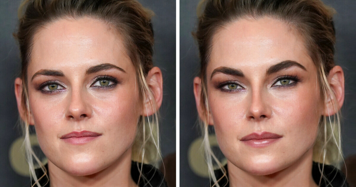 14 Stunning Women Who Would Look Totally Transformed If They Had Cosmetic Surgery 14 Stunning Women Who Would Look Totally Transformed If They Had Cosmetic Surgery