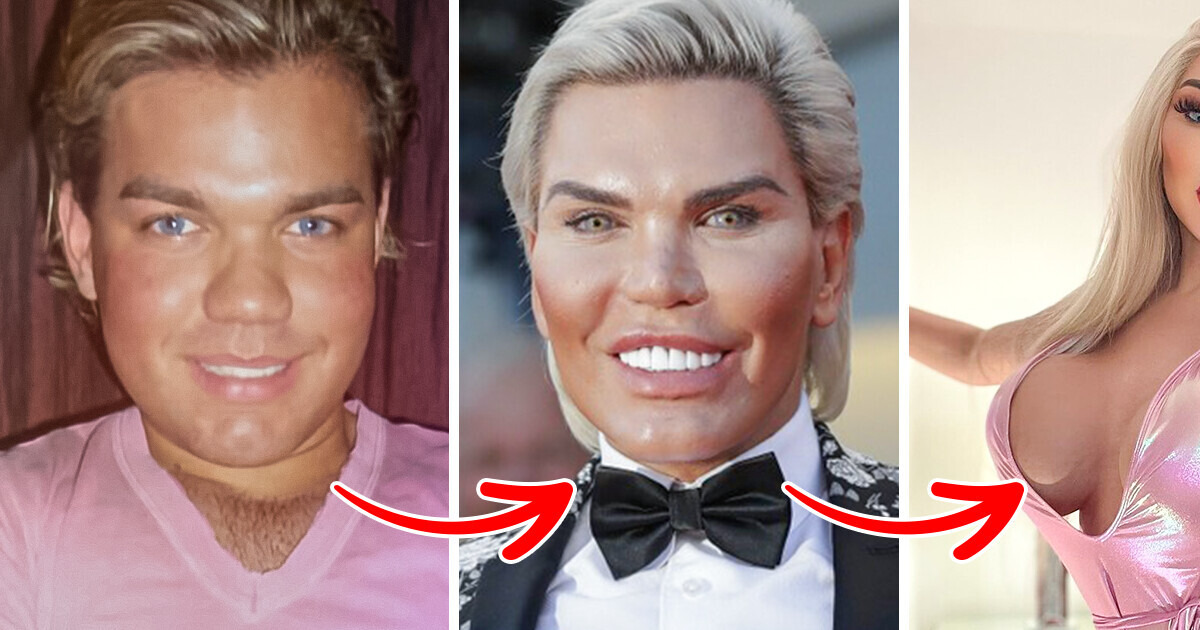 “I’d Like To Look Like This Forever!” Jessica Alves, Who Spent $1 Million on Transformation, Has Stopped Undergoing Surgeries “I’d Like To Look Like This Forever!” Jessica Alves, Who Spent $1 Million on Transformation, Has Stopped Undergoing Surgeries