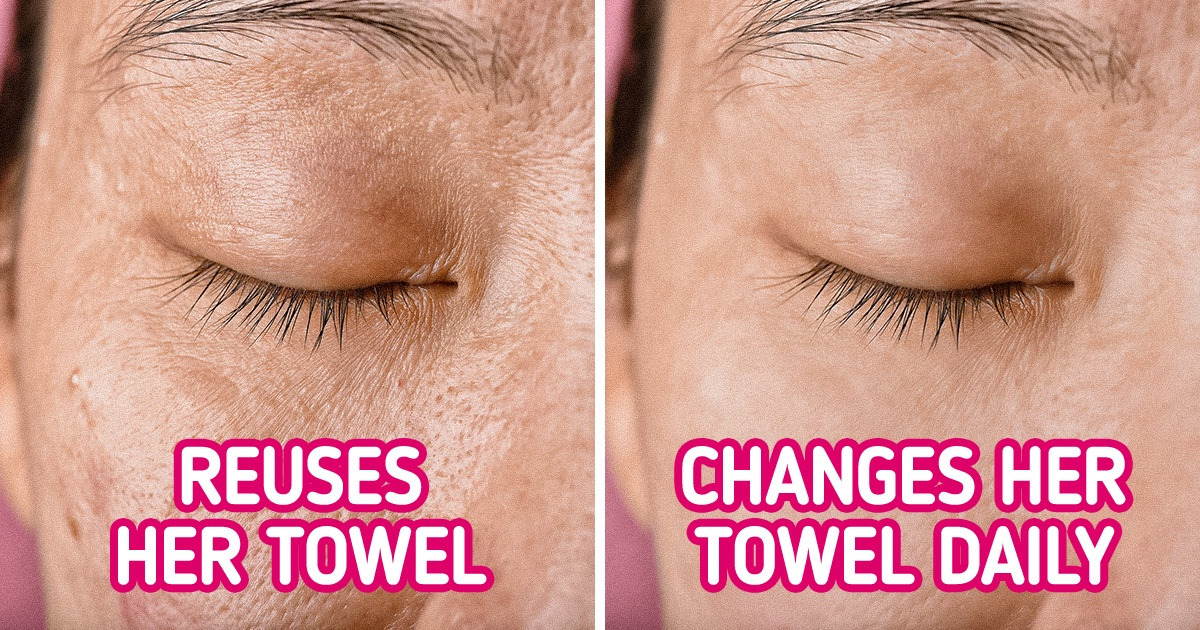 7 Daily Towel Habits You Should Change to Improve Your Hygiene 7 Daily Towel Habits You Should Change to Improve Your Hygiene
