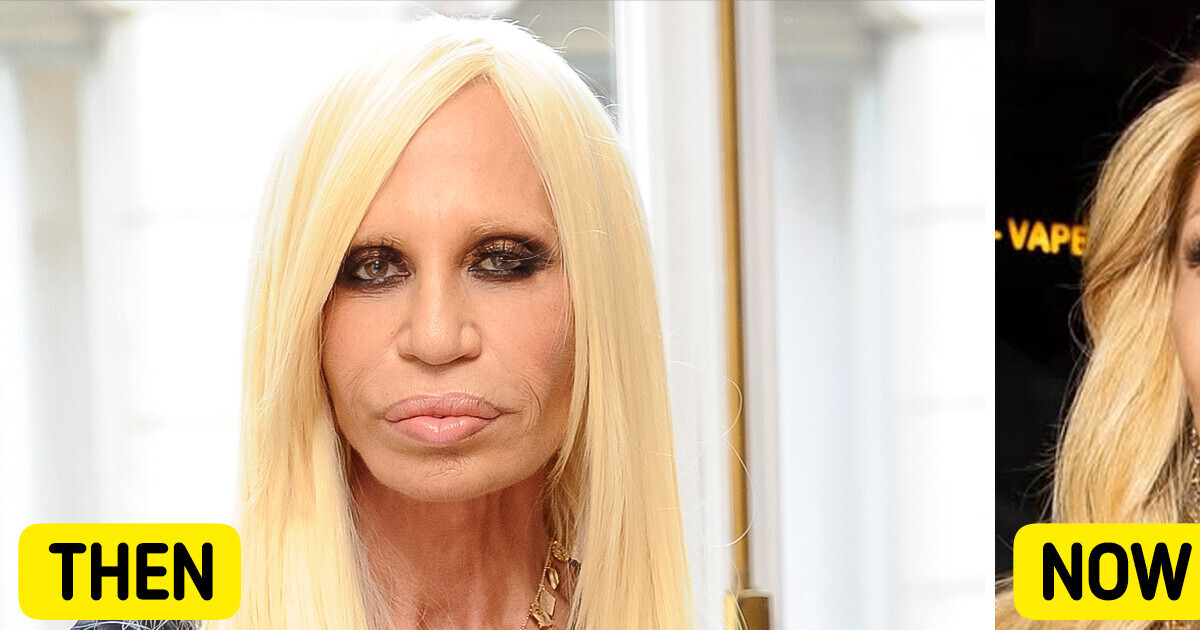Donatella Versace Debuts with a “NEW FACE” — She Looks Unrecognizable! Donatella Versace Debuts with a “NEW FACE” — She Looks Unrecognizable!