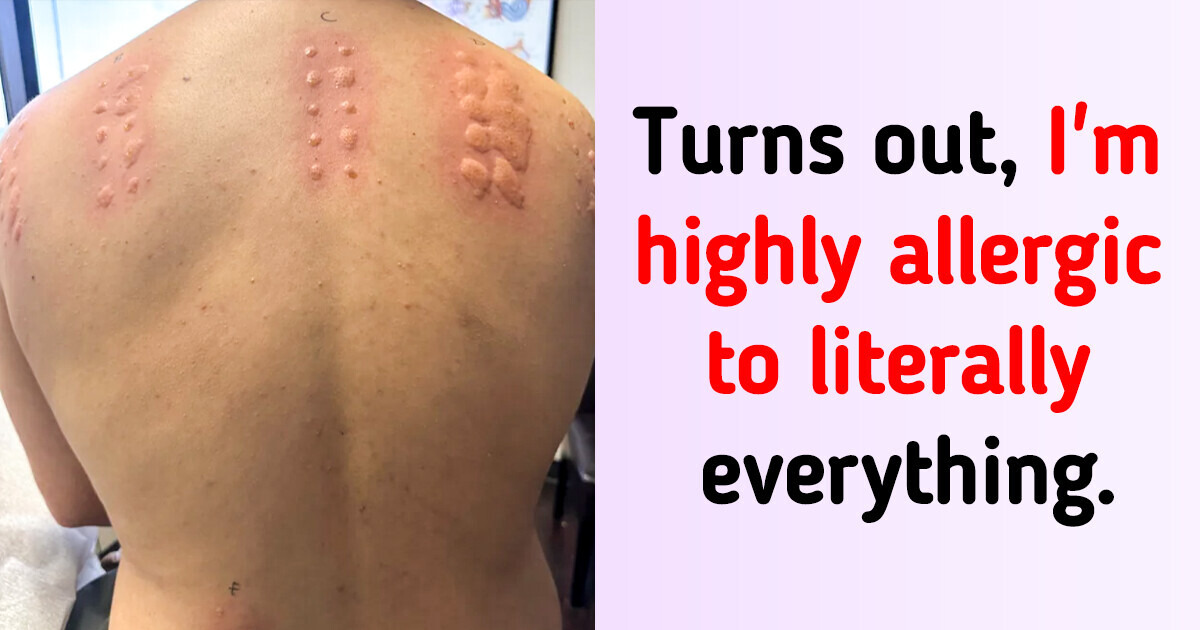 16 Times People Couldn’t Believe How Incredibly Unlucky They Are 16 Times People Couldn’t Believe How Incredibly Unlucky They Are
