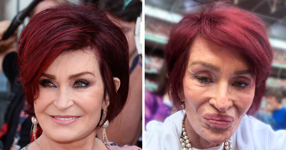 13 Celebrities Who Look Strikingly Different After Cosmetic Procedures 13 Celebrities Who Look Strikingly Different After Cosmetic Procedures