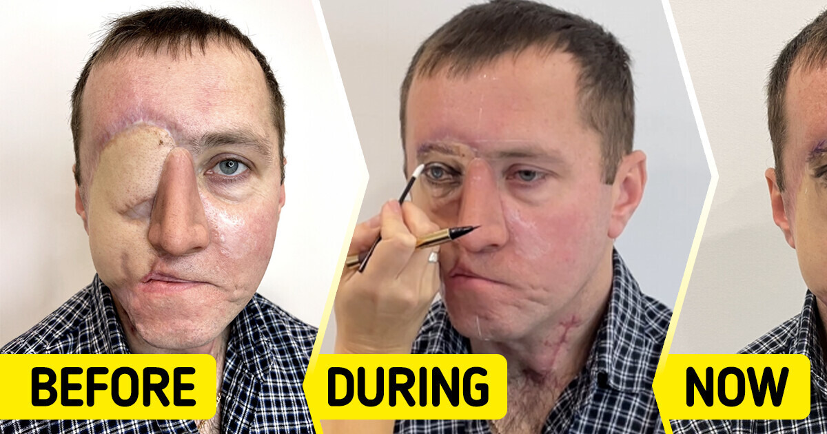 Tattoo Artist Uses Her Skills to Give a Man a “New Permanent Eye” After a Horrific Car Accident