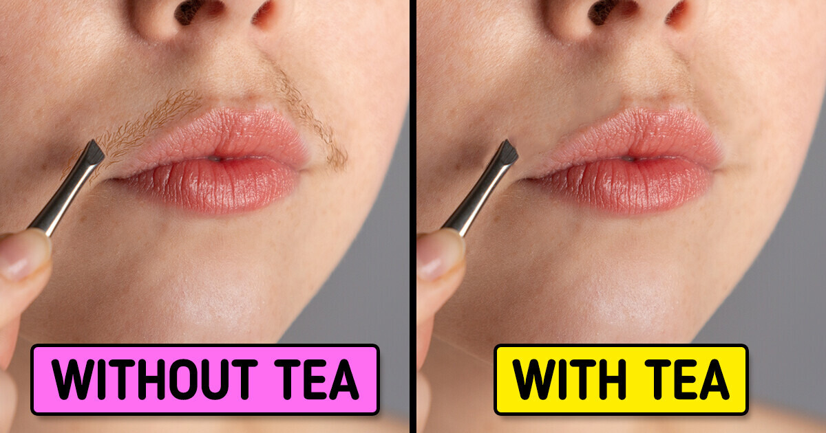 10 Surprising Methods to Remove Your Facial Hair Effectively