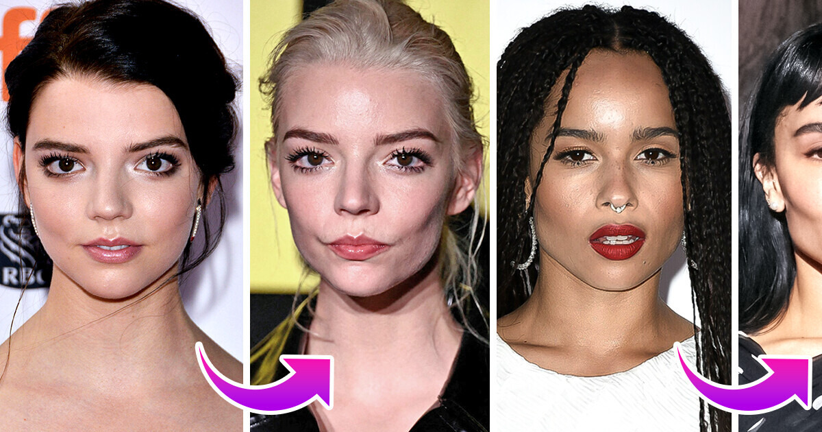 14 Celebrities Who Achieved Chiseled Cheekbones and Drastically Altered Their Looks 14 Celebrities Who Achieved Chiseled Cheekbones and Drastically Altered Their Looks