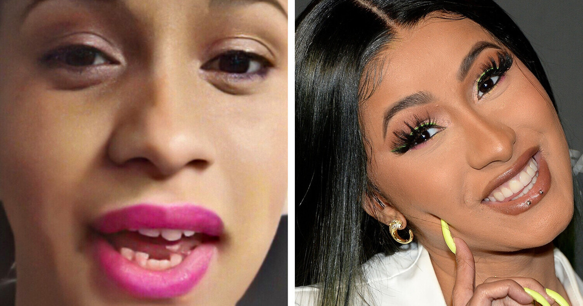 15 People Who Fixed Their Teeth and Can Smile Without Being Self-Conscious 15 People Who Fixed Their Teeth and Can Smile Without Being Self-Conscious