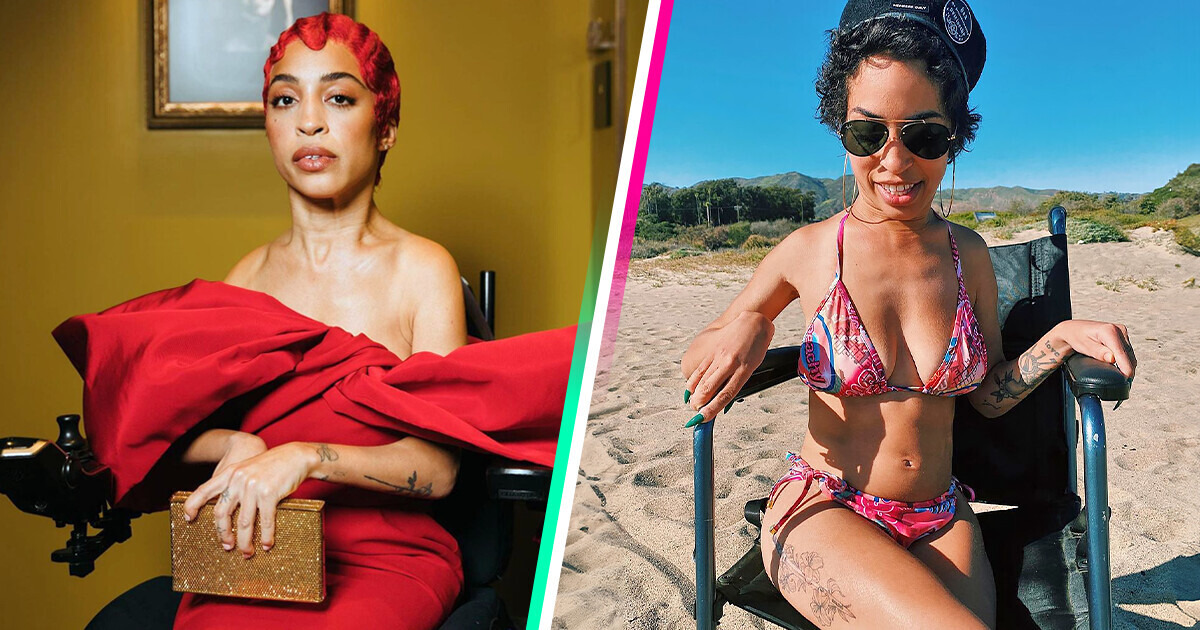 The Story of a Courageous Woman With Disabilities Who Became a Model and Actress Against All Odds