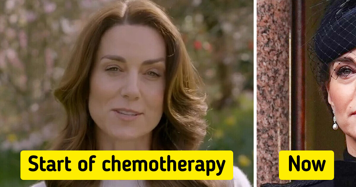 Princess Catherine’s Recent Appearance Sparked Comments, “She Looks Very Unwell” Princess Catherine’s Recent Appearance Sparked Comments, “She Looks Very Unwell”