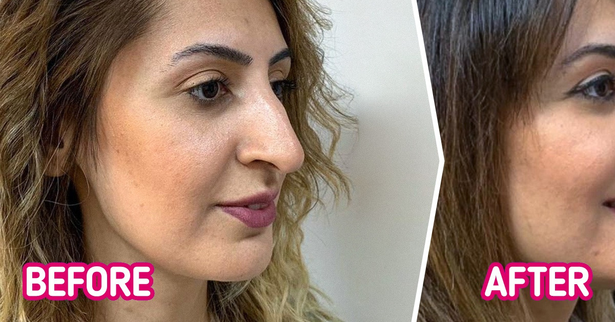 21 Women Who Showed a Small Change to Your Nose Can Go a Long Way 21 Women Who Showed a Small Change to Your Nose Can Go a Long Way