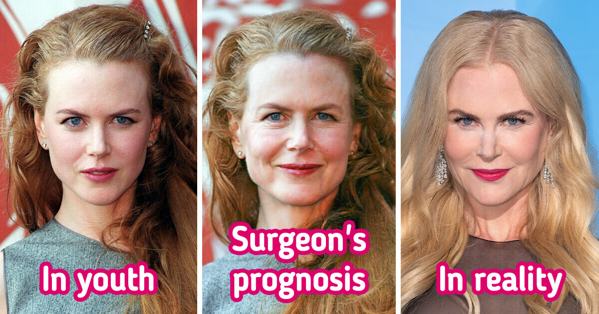 Plastic Surgeon Reveals What Celebrities Would Look Like if They Aged Like Regular People Plastic Surgeon Reveals What Celebrities Would Look Like if They Aged Like Regular People