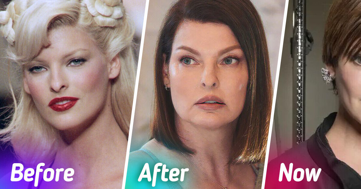 Linda Evangelista Speaks Up About Her Recovery Journey Following a Botched Plastic Surgery Linda Evangelista Speaks Up About Her Recovery Journey Following a Botched Plastic Surgery