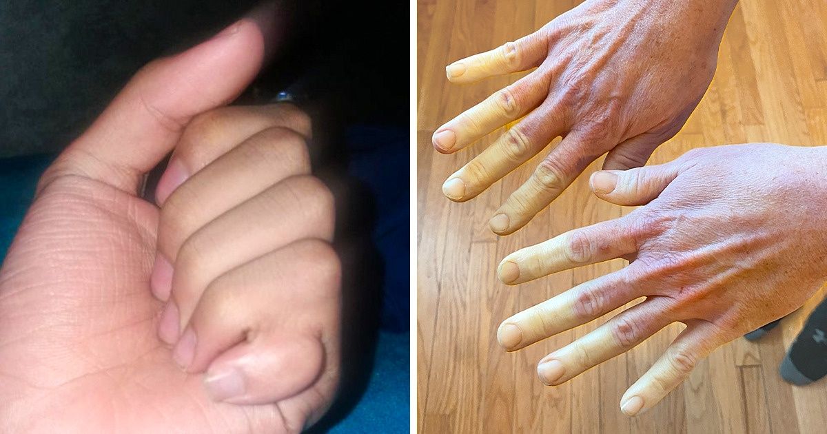 19 People That Nature Gifted With Something Truly Extraordinary