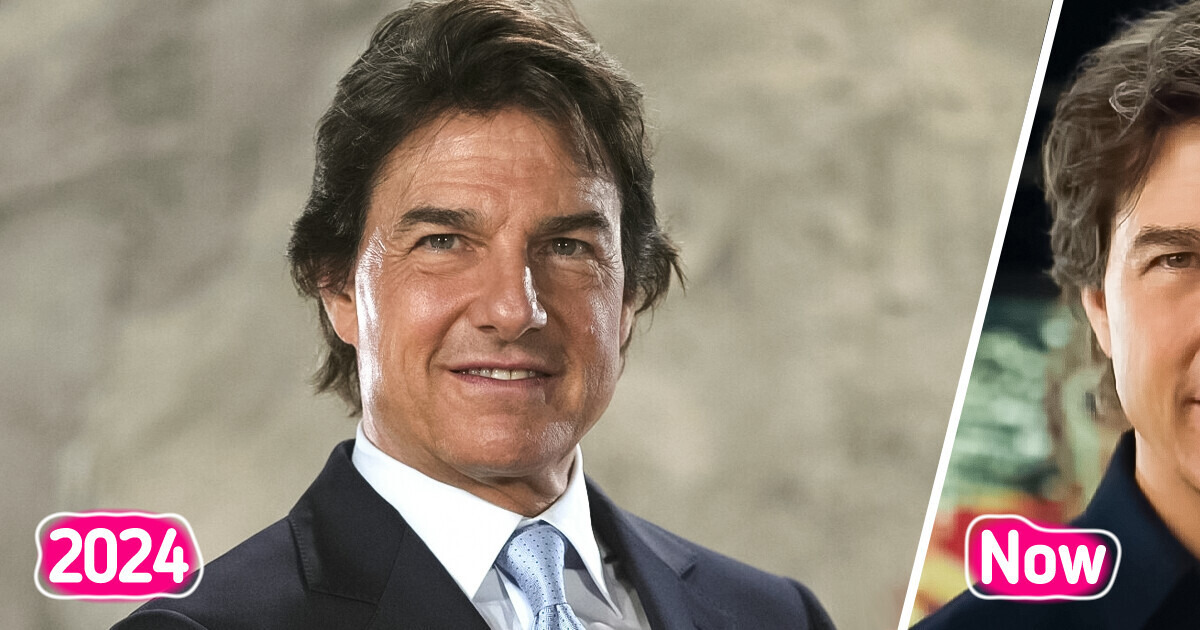 “What’s with His Face?” Tom Cruise’s Altered Appearance Sparks Heated Debate