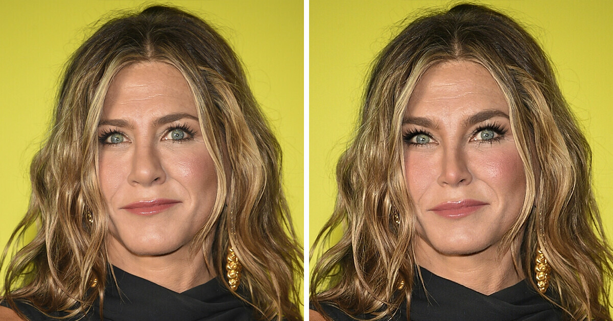 18 Beautiful Stars Who’d Look So Different If They Had Cosmetic Procedures