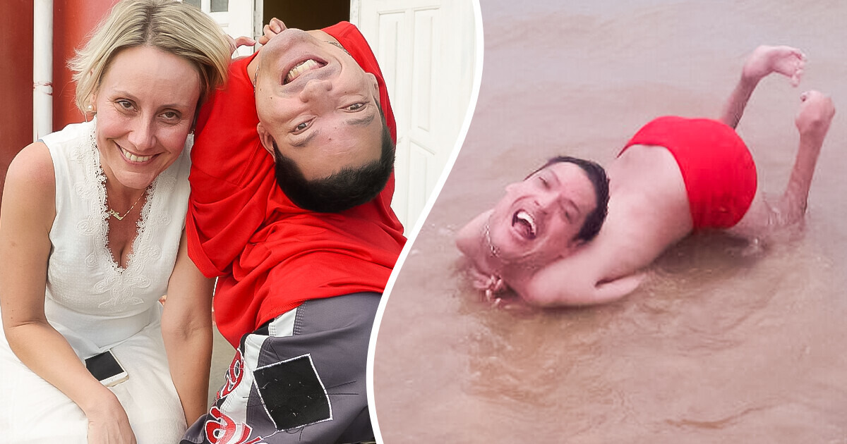 Man With an “Upside-Down Head” Was Given 24 Hours to Live, and Now He Inspires People and Refuses to Have Surgery Man With an “Upside-Down Head” Was Given 24 Hours to Live, and Now He Inspires People and Refuses to Have Surgery