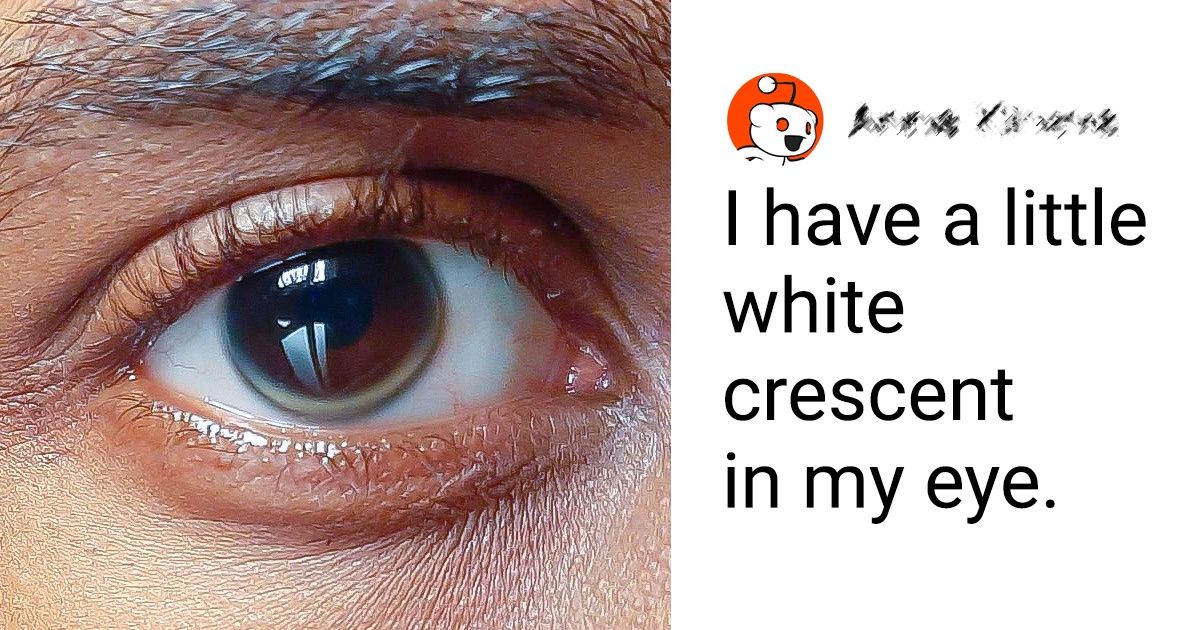 19 People Who Aren’t Afraid to Show Off Their One-of-a-Kind Features
