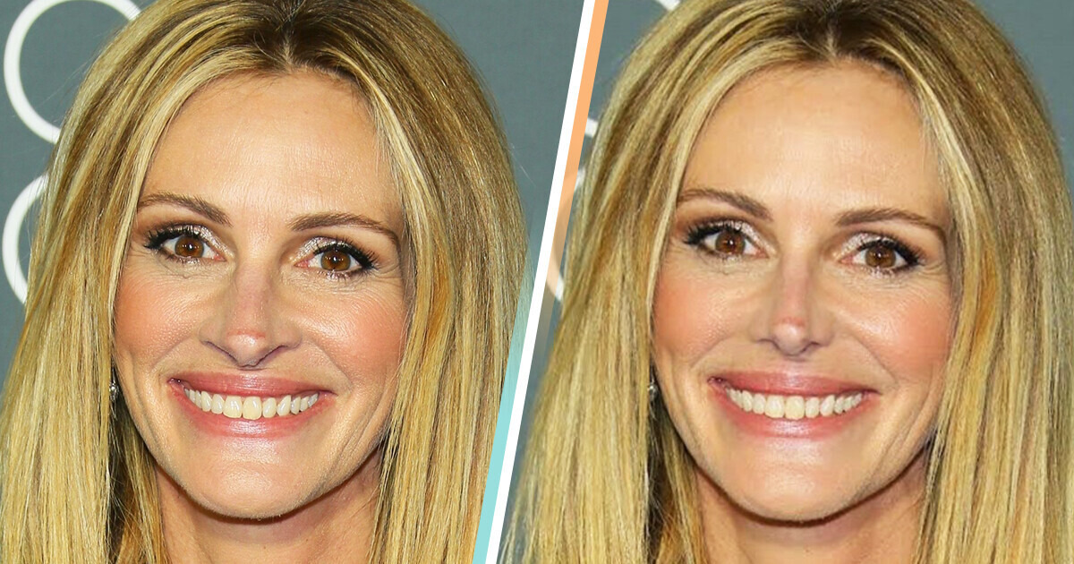 14 Beautiful Stars Who Would Look Totally Different With Another Nose Shape