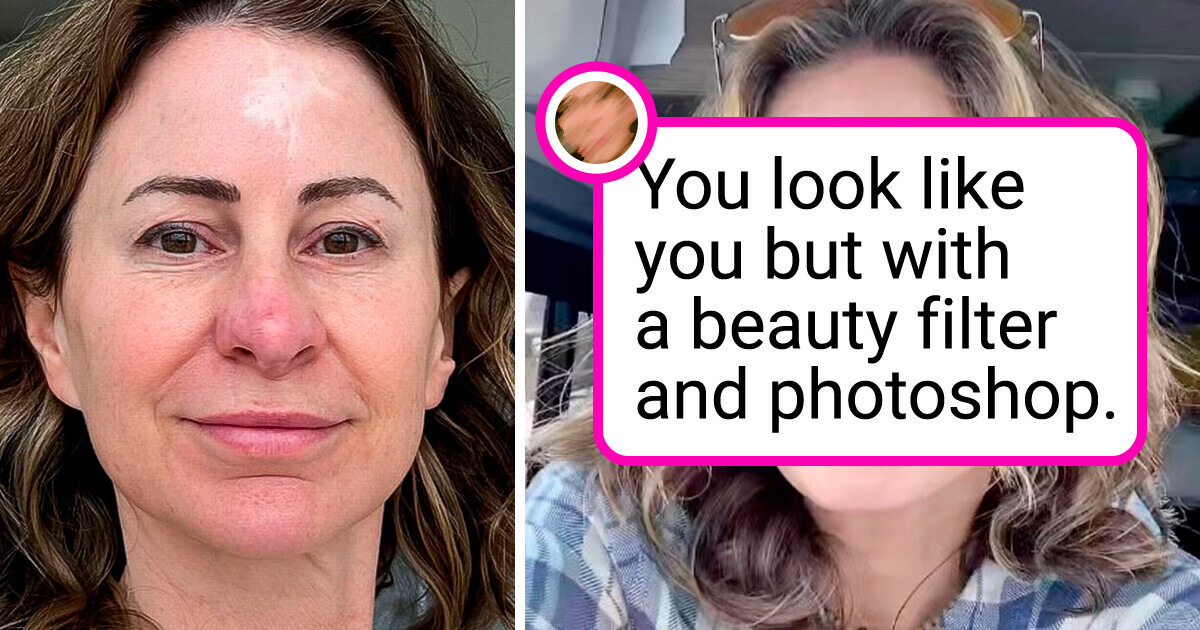 A Woman Gave Up Her Home and Everything She Had for a Face Lift. But Her Loved Ones Are Wondering, “Was It Worth It?”