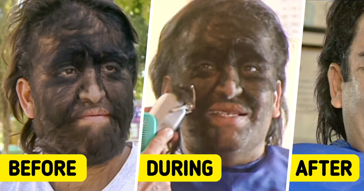 The Wolf Man Tires of Being a “Freak”, Yet Faces Struggles in Seeking a Job Beyond the Circus