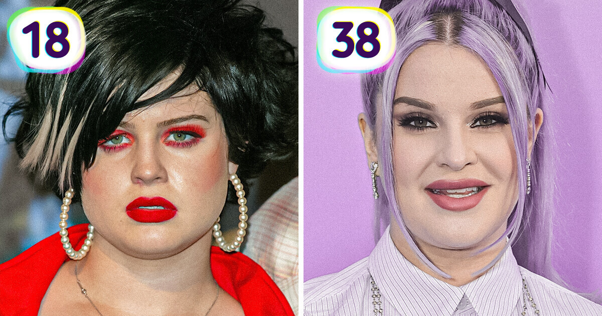 18 Stars Whose Transformation is Beyond Dazzling 18 Stars Whose Transformation is Beyond Dazzling