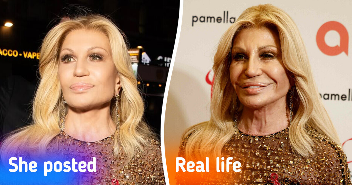 17 Celebrity Photos Revealing the Striking Difference Between Social Media and Reality 17 Celebrity Photos Revealing the Striking Difference Between Social Media and Reality