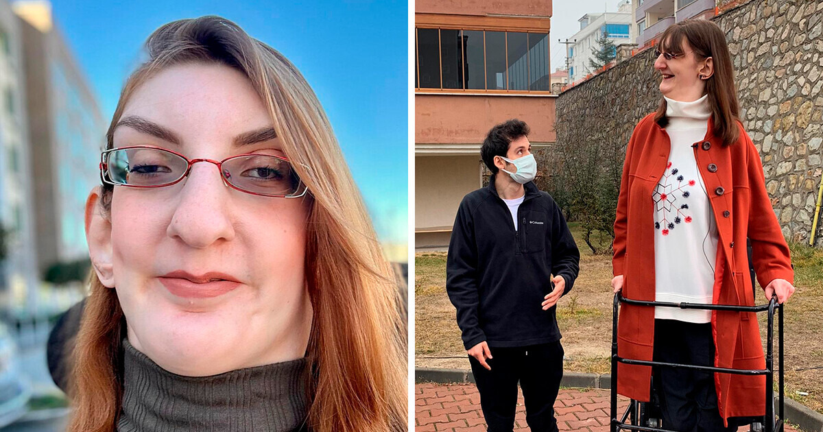 The Story of Rumeysa Geigi Who Was Born Unique and Became the Tallest Woman on Earth