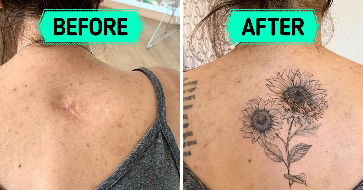 12 People That Decided to Embrace Their Scars by Turning Them Into True Works of Art