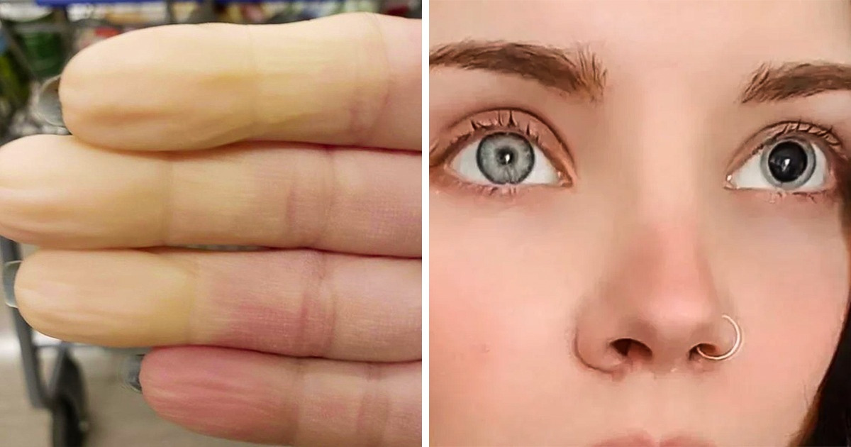 15 People Share How Nature Decided to Experiment on Them