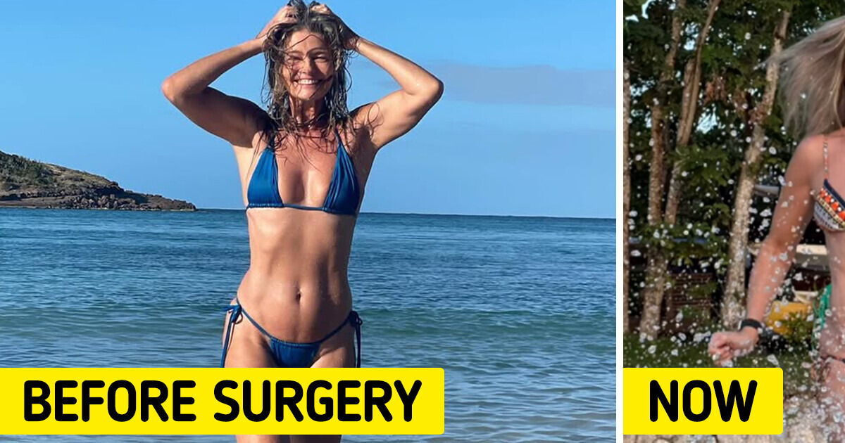 Paulina Porizkova, 59, Embraces Her Body After Weight Gain Following Surgery Paulina Porizkova, 59, Embraces Her Body After Weight Gain Following Surgery