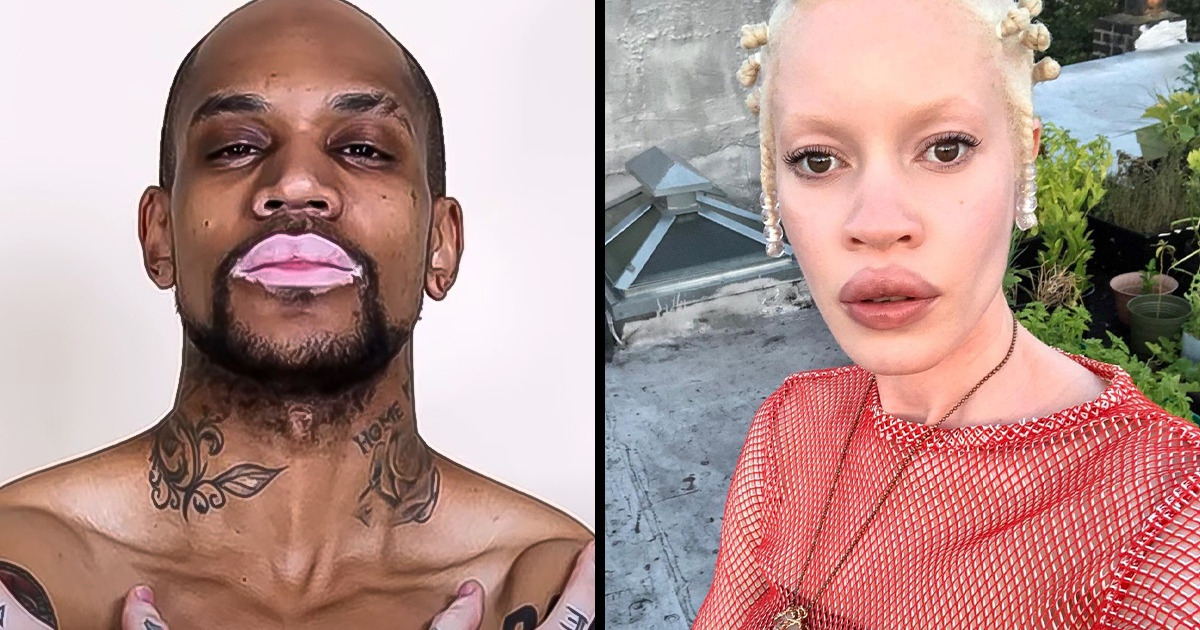 15 Unique People Who Were Gifted With One-in-a-Million Genetics