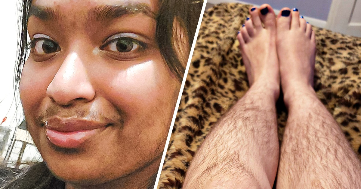 15 Beautiful Women Who Decided to Forgo Razor and Waxing