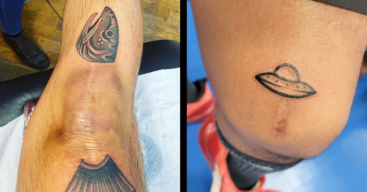 16 People Who Didn’t Let a Scar or Birthmark Define Them and Instead Turned Them Into Tattoos