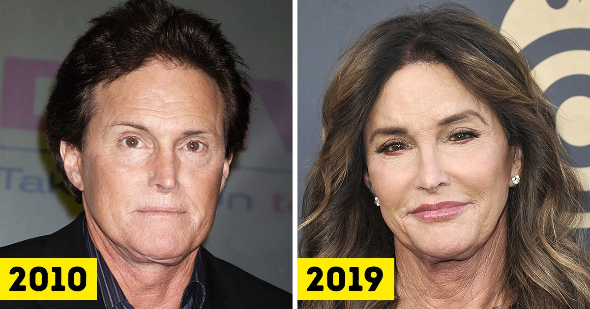 15+ Celebrities That Have Changed So Much Over the Years That We(02)