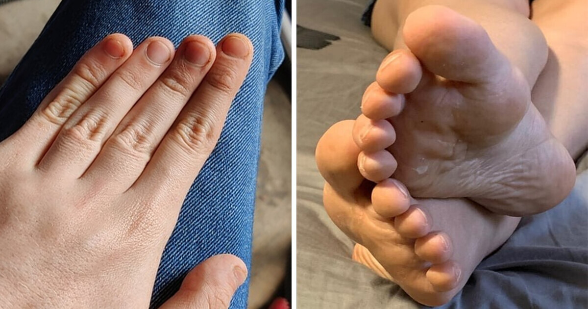 11 Exceptional Body Traits That Make You Truly Unique