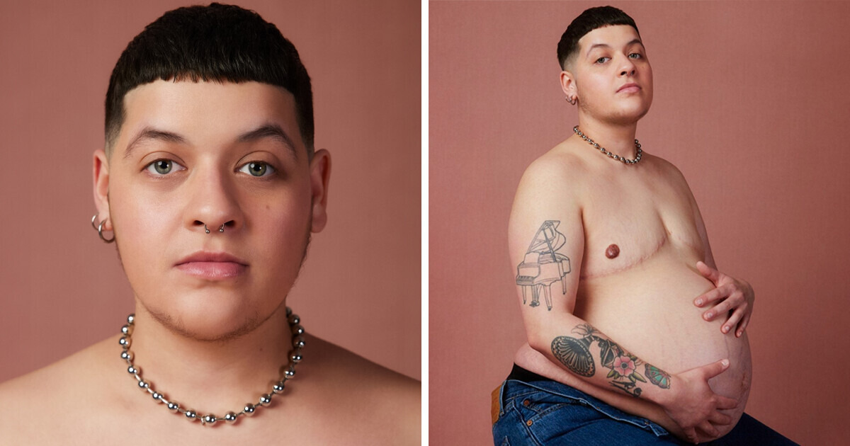 An Unusual Story of a Transgender Man Who Discovered He Was Pregnant and Decided To Give Birth to a Child An Unusual Story of a Transgender Man Who Discovered He Was Pregnant and Decided To Give Birth to a Child