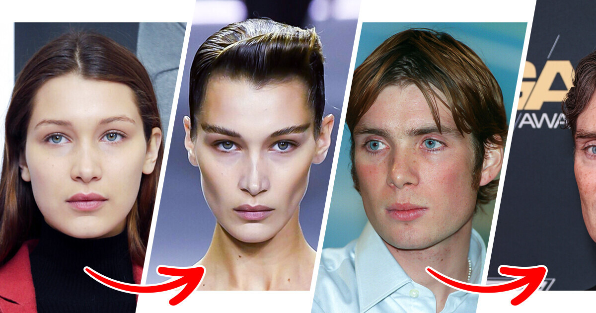 14 Celebrities Who Look Strikingly Different After Achieving Chiseled Cheekbones 14 Celebrities Who Look Strikingly Different After Achieving Chiseled Cheekbones