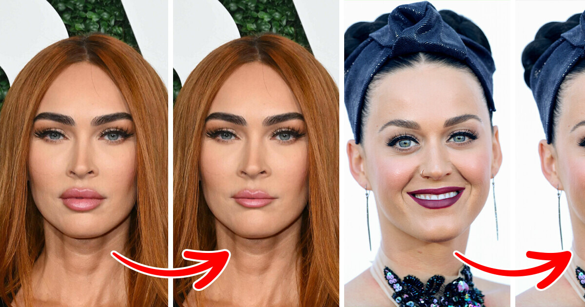 What Would 11 Stars Look Like if They Didn’t Do Drastic Beauty Procedures in Pursuit of Hollywood Ideals What Would 11 Stars Look Like if They Didn’t Do Drastic Beauty Procedures in Pursuit of Hollywood Ideals