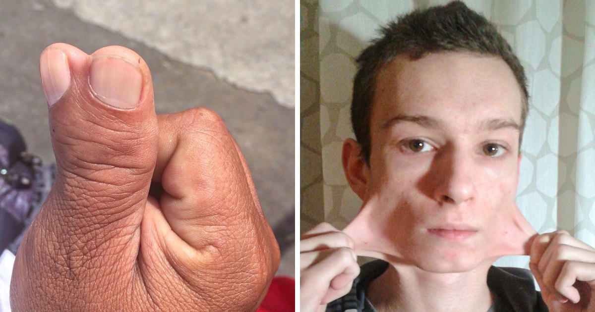 10+ People and Animals Whose Very Special Features Add to Their Charisma