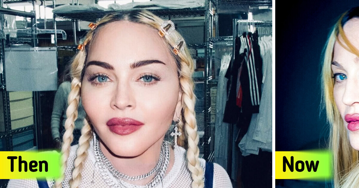 “What Have You Done to Your Face?” Madonna, 66, Unveils Bold New Look in Recent Photos “What Have You Done to Your Face?” Madonna, 66, Unveils Bold New Look in Recent Photos