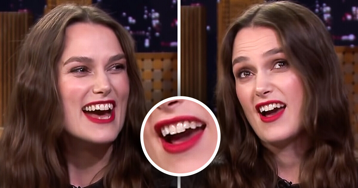 11 Celebrity Women Who Proudly Ignore Any Beauty Standards