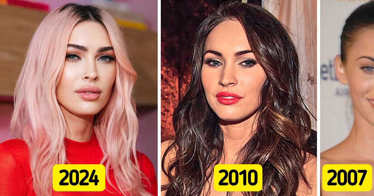 Megan Fox, 37, Openly Shared Plastic Surgeries She Has Undergone, Except One She Will Never Do Megan Fox, 37, Openly Shared Plastic Surgeries She Has Undergone, Except One She Will Never Do