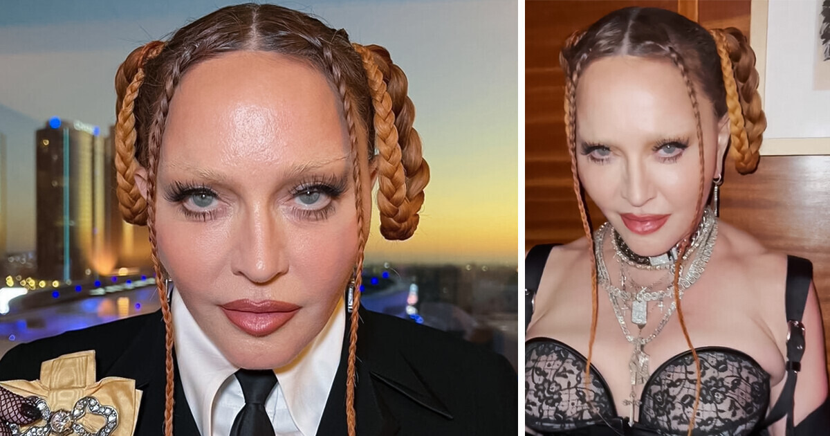 Madonna’s Smooth Face Has Been Discussed for Many Months, and a Close Source Reveals That She Wants to Return to Her Natural Face Madonna’s Smooth Face Has Been Discussed for Many Months, and a Close Source Reveals That She Wants to Return to Her Natural Face