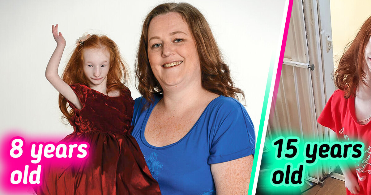 “The Tiniest Girl” Who Survives Against All Odds and Doctors’ Predictions Celebrates Her 16th Birthday “The Tiniest Girl” Who Survives Against All Odds and Doctors’ Predictions Celebrates Her 16th Birthday
