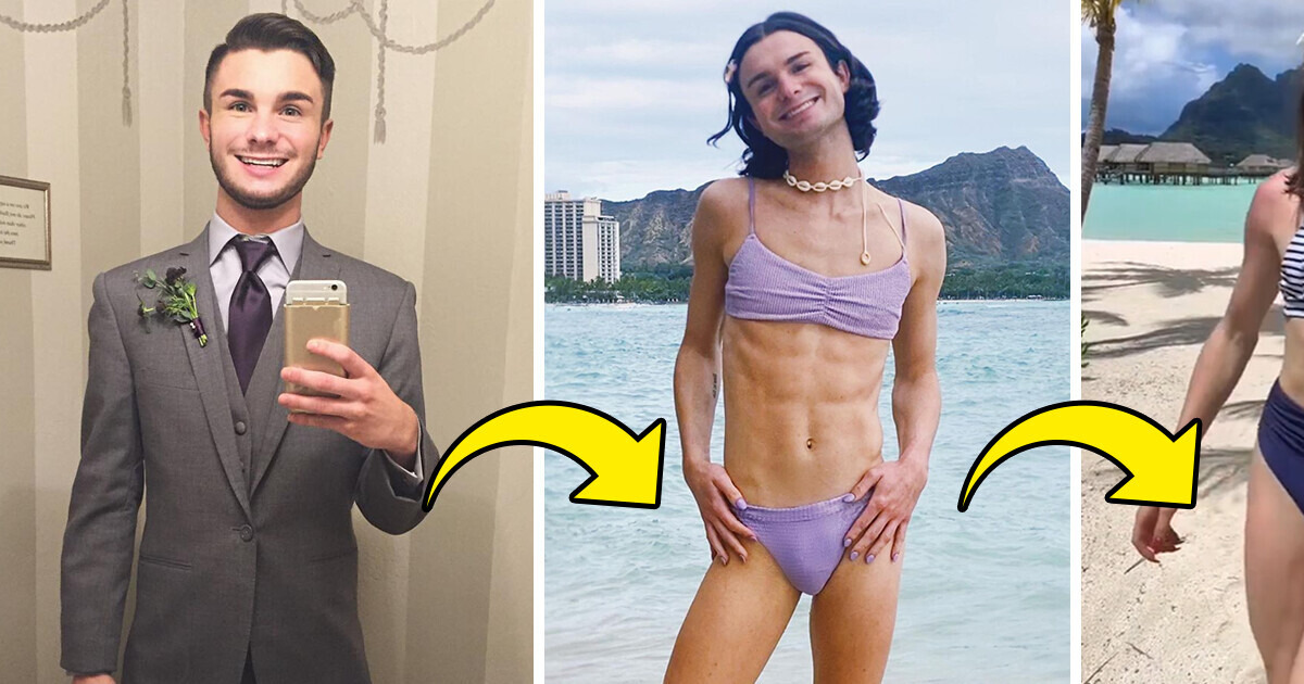 Dylan Mulvaney Reveals Crazy Results of Her Feminization Surgery