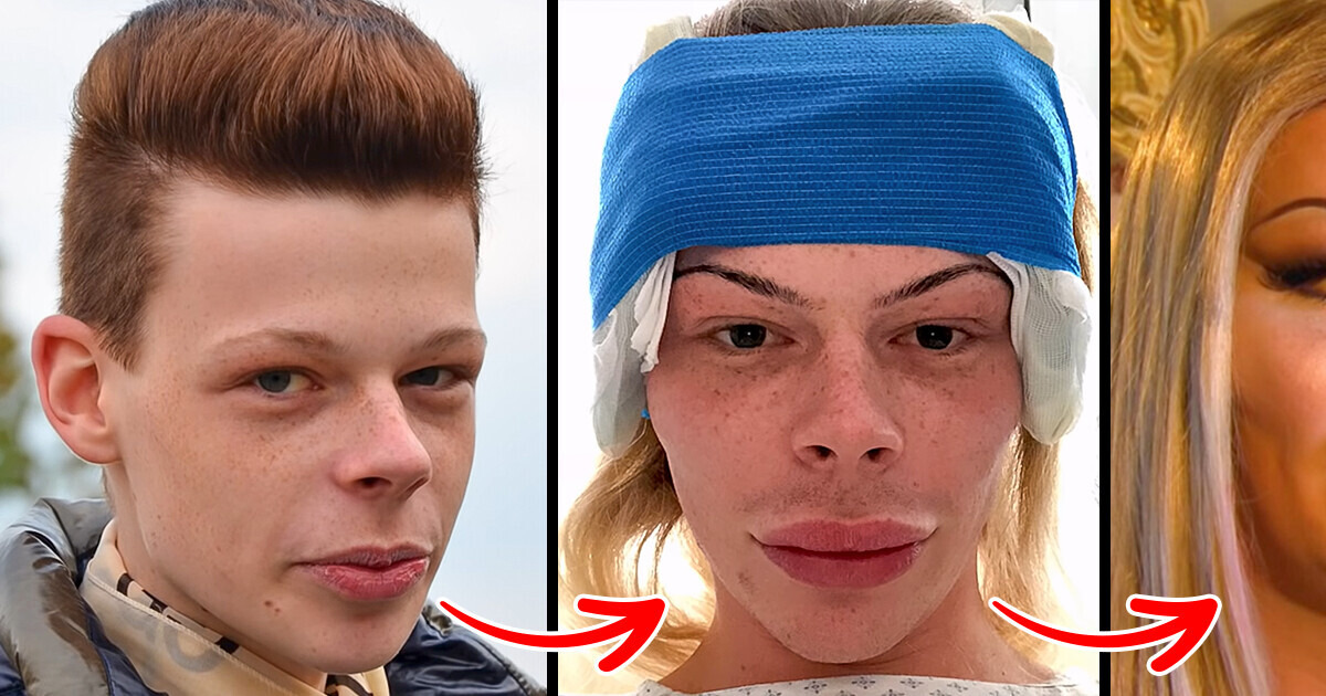 Meet Patrick Mast, Who Spent $73,000 To Look Like a Doll Meet Patrick Mast, Who Spent $73,000 To Look Like a Doll