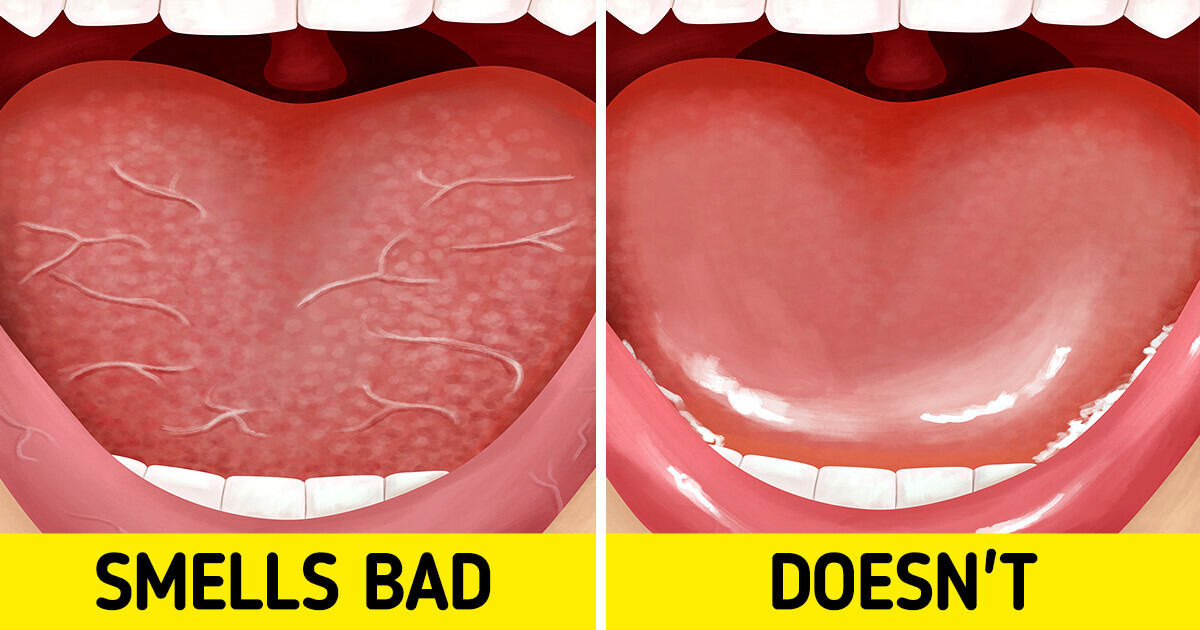 6 Effective Ways To Avoid Bad Breath Even After Sleeping 6 Effective Ways To Avoid Bad Breath Even After Sleeping