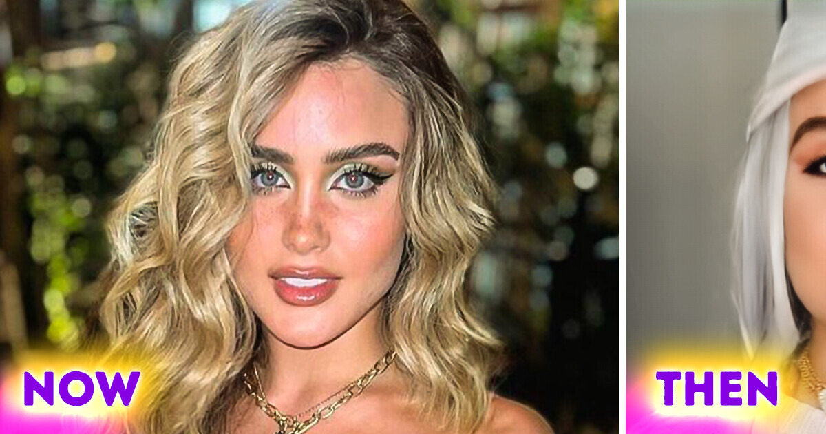 22-Year-Old Woman Bought Herself a New Face and Body for $30K