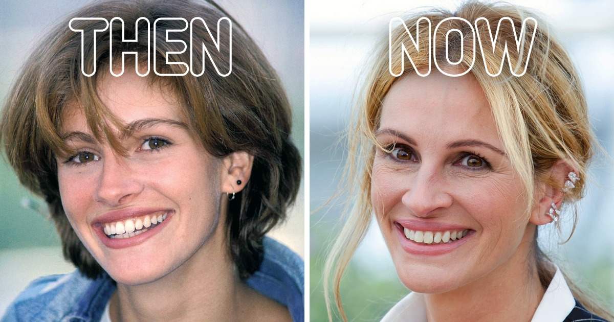 8 Celebrities Who Refrained From Cosmetic Surgery and Embraced Their Natural Beauty 8 Celebrities Who Refrained From Cosmetic Surgery and Embraced Their Natural Beauty