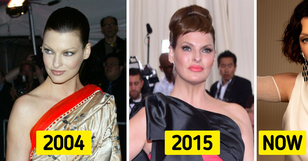 Linda Evangelista Triumphant Return to Met Gala After Delicate Procedure Which Caused “Permanently Deformed” Linda Evangelista Triumphant Return to Met Gala After Delicate Procedure Which Caused “Permanently Deformed”