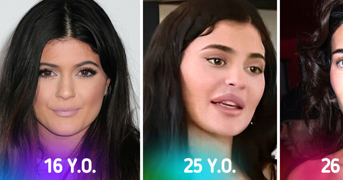«You Look Like 50.» People Are Accusing Kylie Jenner of Excessive Plastic Surgery and Filters «You Look Like 50.» People Are Accusing Kylie Jenner of Excessive Plastic Surgery and Filters
